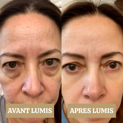 LUMIS: Patchs LED + Microcourant Contour des Yeux