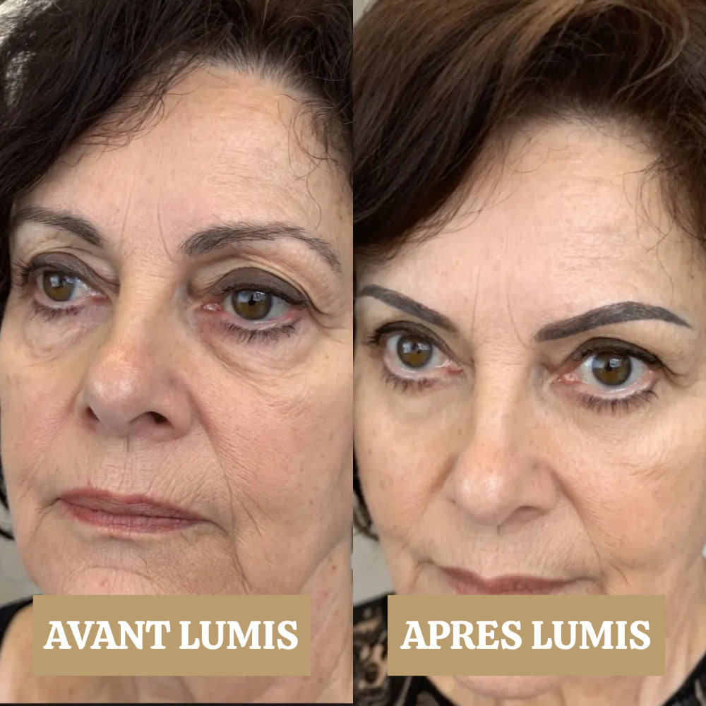 LUMIS: Patchs LED + Microcourant Contour des Yeux