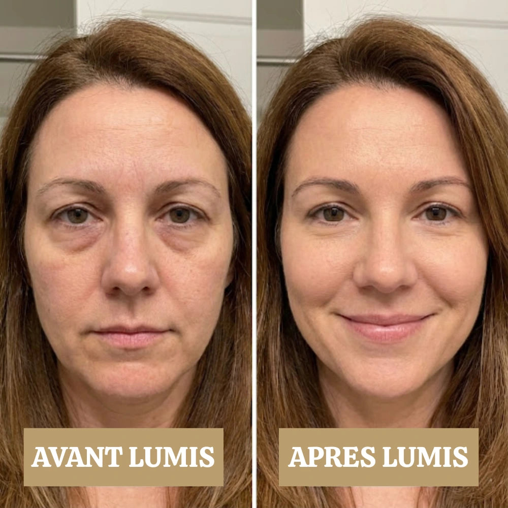 LUMIS: Patchs LED + Microcourant Contour des Yeux