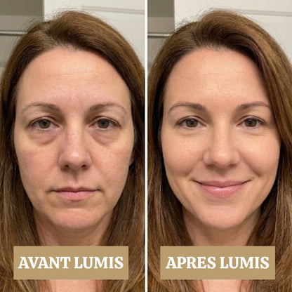 LUMIS: Patchs LED + Microcourant Contour des Yeux