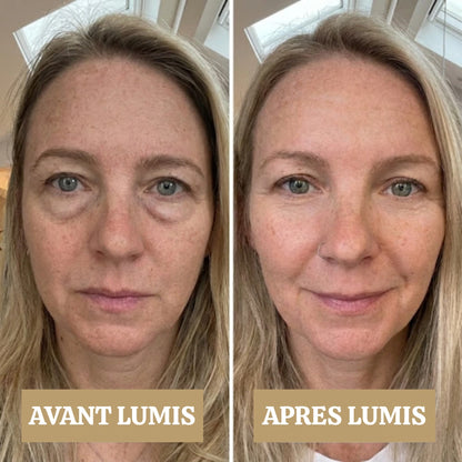 LUMIS: Patchs LED + Microcourant Contour des Yeux