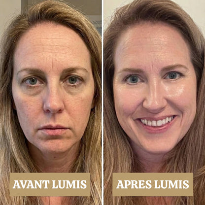 LUMIS: Patchs LED + Microcourant Contour des Yeux