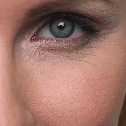 LUMIS: Patchs LED + Microcourant Contour des Yeux